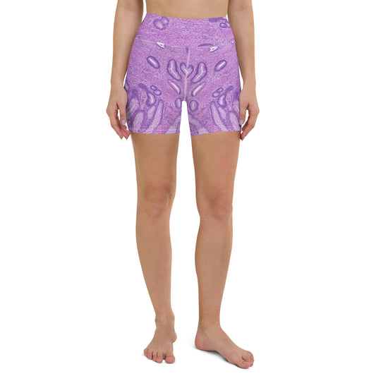 Yoga Shorts - "Purple Problem" - Stage 3 Breast Cancer Yoga Shorts - "Purple Problem" - Stage 3 Breast Cancer